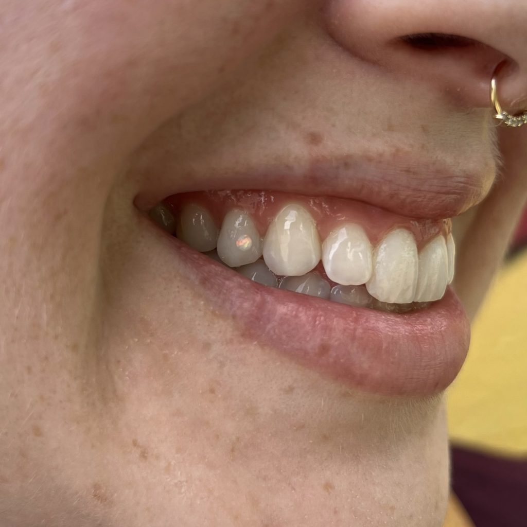 Facetune_01-06-2024-19-20-38